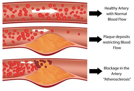 cholesterol explained